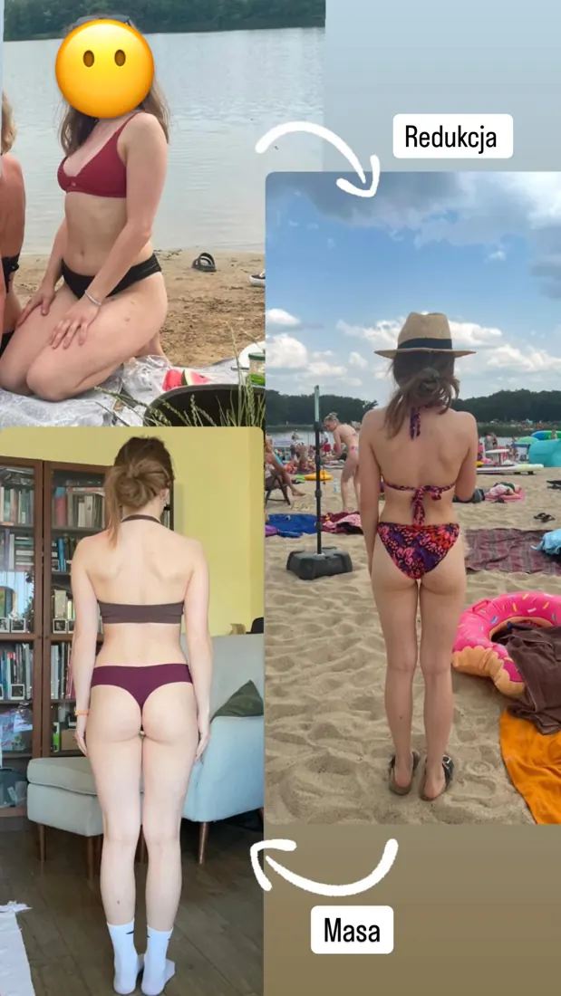 Marlena – zdjęcia przed i po