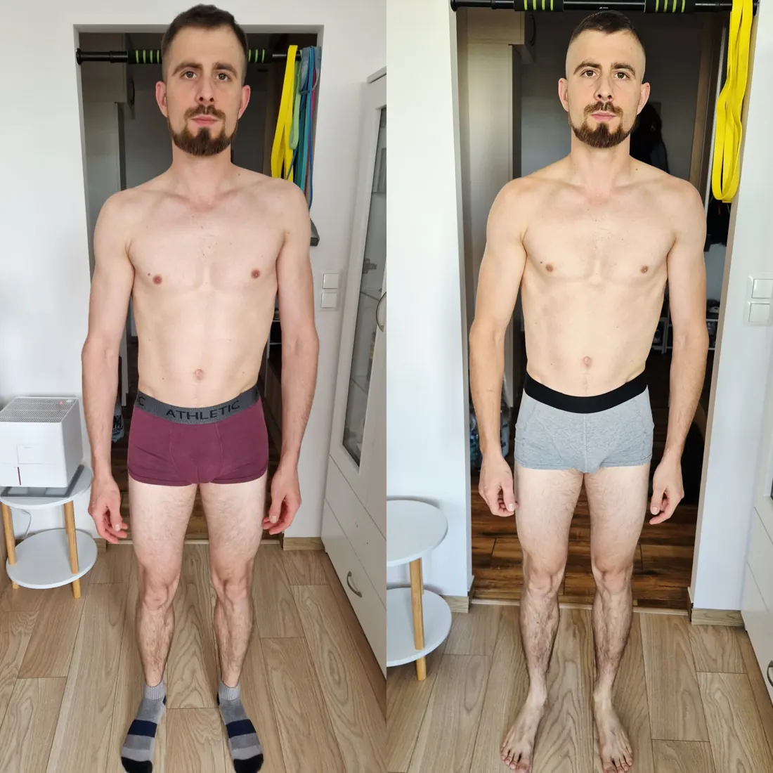 Patryk – zdjęcia przed i po